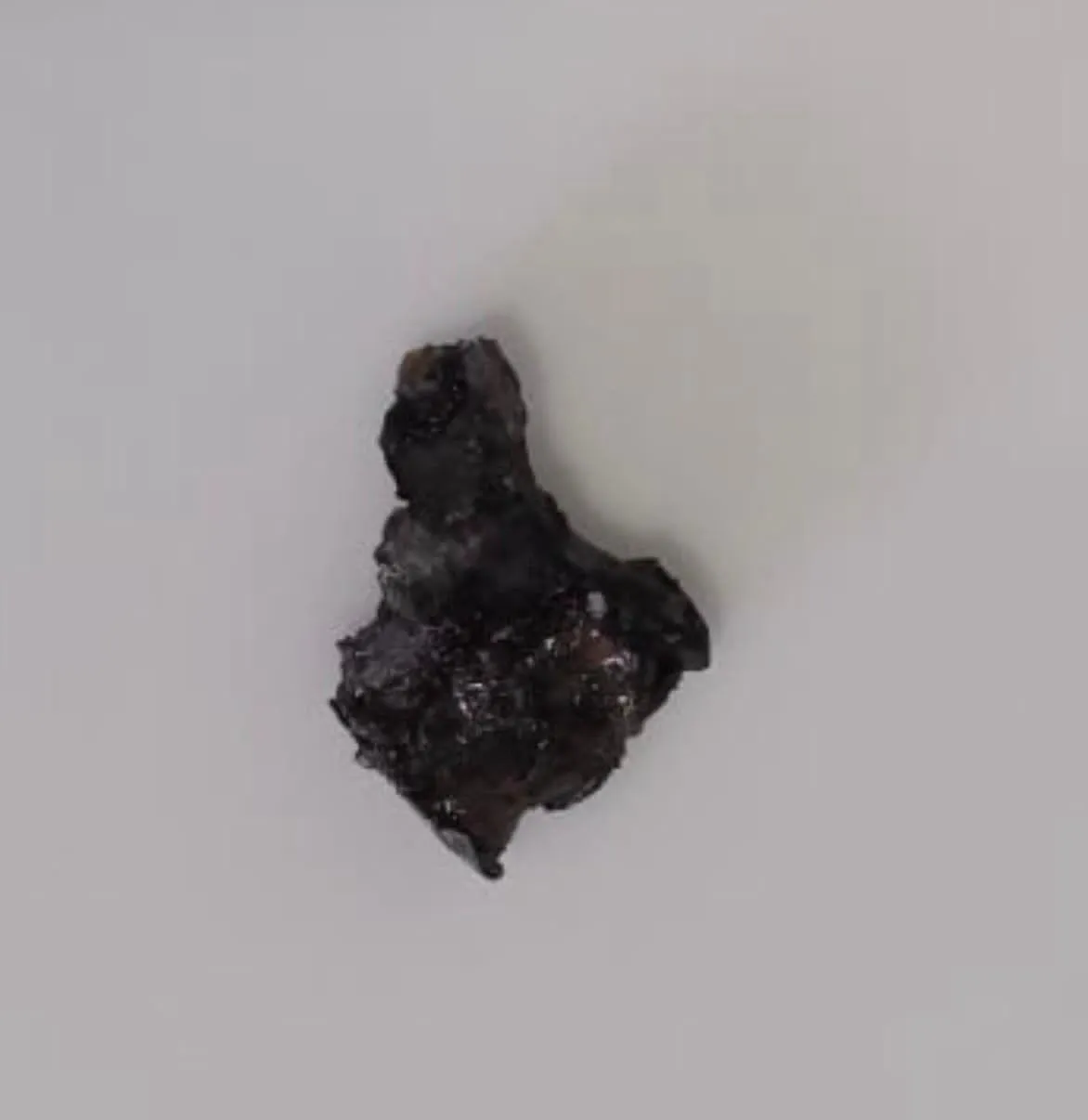 הרסיס שפצע את בניה סמוטריץ