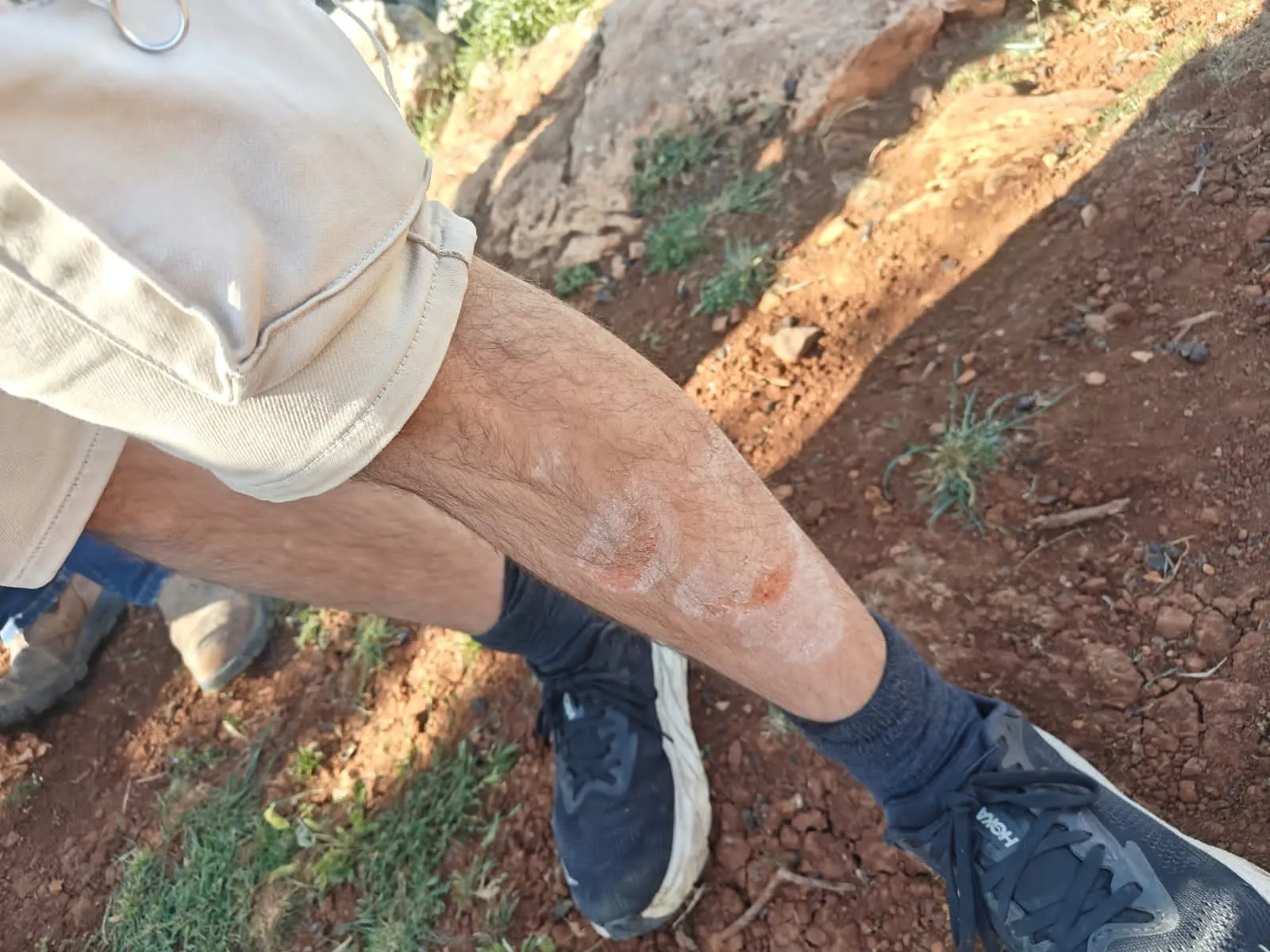 המטיילים שהותקפו ליד הישוב עופרה