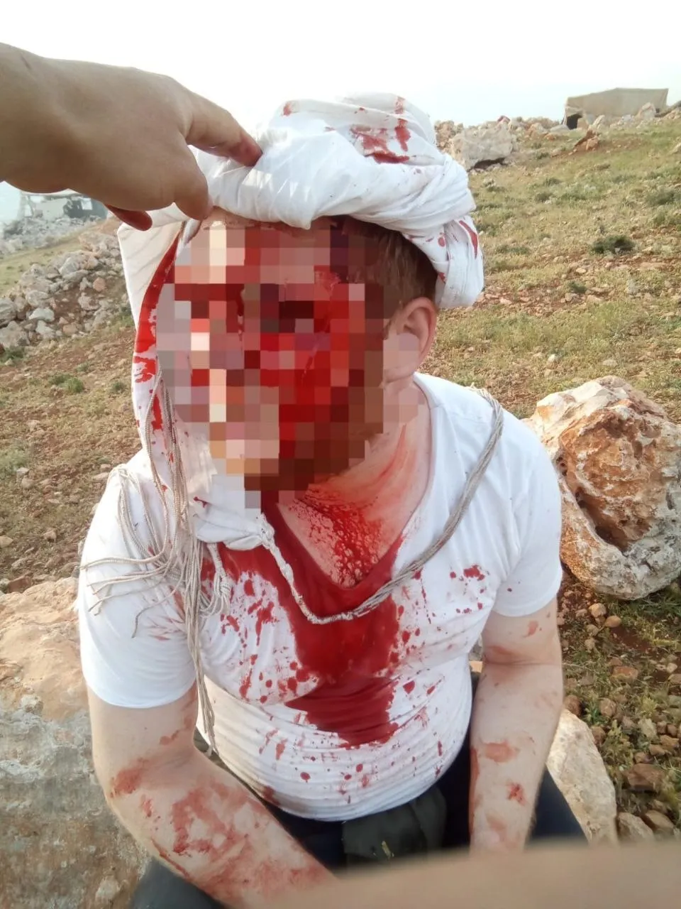 פצוע קשה בתקיפת פורעים ערבים ליד הכפר דומא