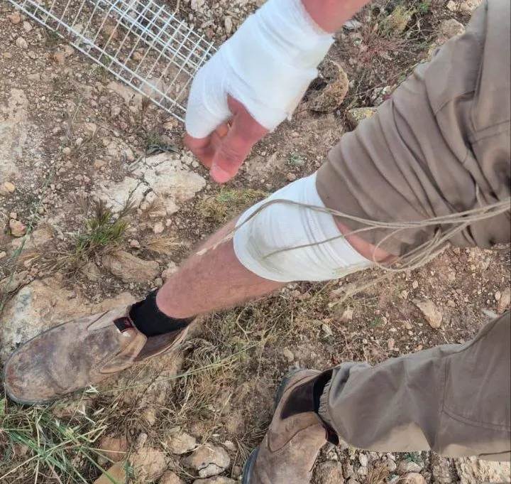 פורעים ערבים תקפו רועה צאן בחוות חסד לאברהם