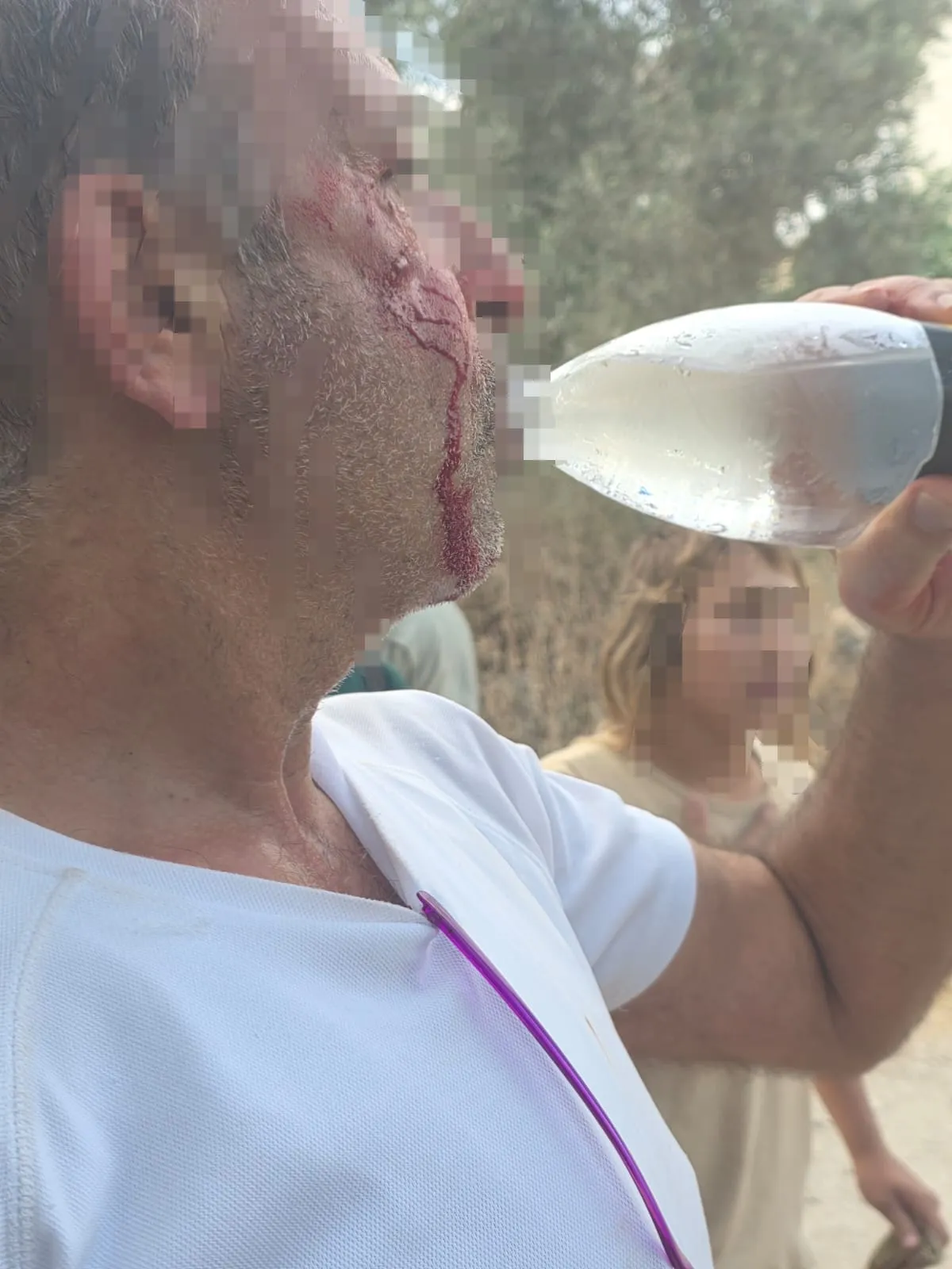 אחד הפצועים היהודים