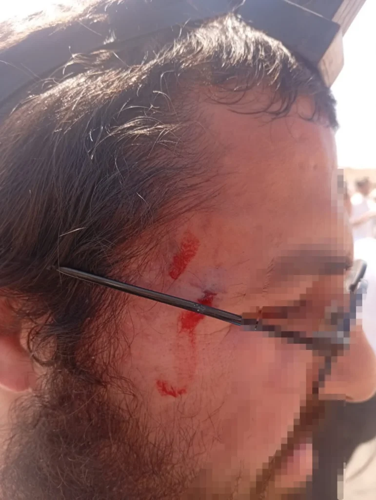 טרור בגוש עציון: מאות פורעים ערבים תקפו מטיילים